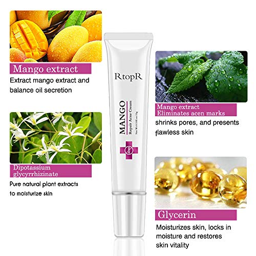 Crema para el acné, Crema para el acné, Crema para el tratamiento del acné, Crema para el tratamiento de la cicatriz del acné, Crema contra el acné, Crema antipinilla, Equilibrio con agua y aceite