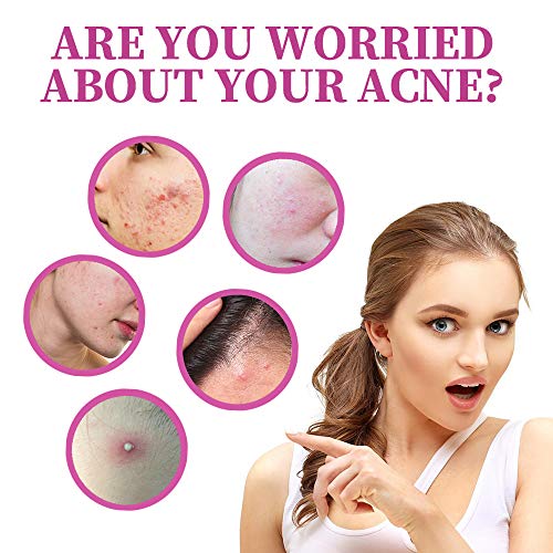 Crema para el acné, Crema para el acné, Crema para el tratamiento del acné, Crema para el tratamiento de la cicatriz del acné, Crema contra el acné, Crema antipinilla, Equilibrio con agua y aceite