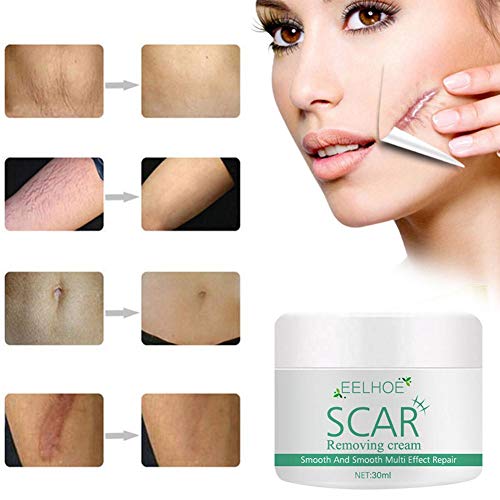 Crema para Eliminar Cicatrices, Gel Avanzado para Cicatrices Crema para Cicatrices Loción Hidratante Antienvejecimiento Eliminador De Marcas Tratamiento De Reparación De La Piel para Atenuar