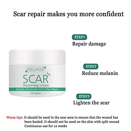 Crema para Eliminar Cicatrices, Gel Avanzado para Cicatrices Crema para Cicatrices Loción Hidratante Antienvejecimiento Eliminador De Marcas Tratamiento De Reparación De La Piel para Atenuar