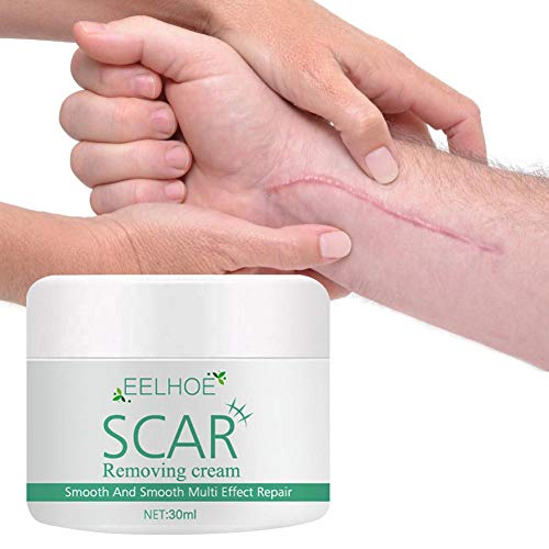 Crema para Eliminar Cicatrices, Gel Avanzado para Cicatrices Crema para Cicatrices Loción Hidratante Antienvejecimiento Eliminador De Marcas Tratamiento De Reparación De La Piel para Atenuar