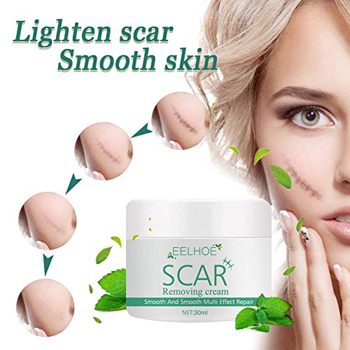 Crema para Eliminar Cicatrices, Gel Avanzado para Cicatrices Crema para Cicatrices Loción Hidratante Antienvejecimiento Eliminador De Marcas Tratamiento De Reparación De La Piel para Atenuar