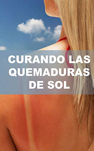 Curando las Quemaduras del sol