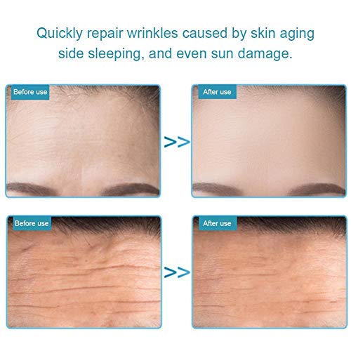 Cuttey Almohadillas para Arrugas EN LA Frente - Parche Antiarrugas en Las Arrugas de la Frente, se Despierta luciendo más Joven, Reduce Las Arrugas Profundas de la Frente Durante la Noche