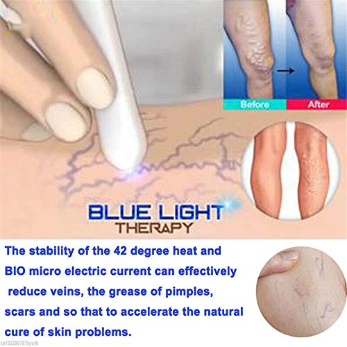 DBWICH Bolígrafo de Terapia de luz Azul para Venas varicosas, bolígrafo de luz Azul para arañas vasculares, bolígrafo de eliminación de acné, máquina de Terapia de Cicatrices Suaves (2 Piezas)