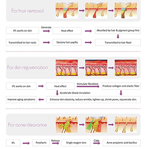 DEESS IPL Dispositivo de depilación iLight 2, versión de aceleración de uso doméstico. Color de la flor.