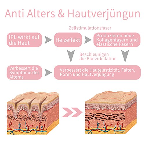 deess IPL dispositivo gp586 ersatzkartuschen Recambio, 350.000 veces Luz Impulse, piel verjüngung, SR