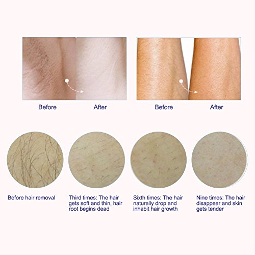 Depiladora luz pulsada LED sin dolor Máquina Depilación Permanente de la belleza removedor de vello para cuerpo brazos Piernas Axila Bikini (UE)