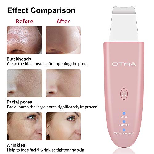 Depurador de la piel, Skin Scrubber OTHA Espátula de piel limpiadora facial -Extractor de comedones- Limpiador ultrasónico de poros -Masajeador Facial Lifting Tool