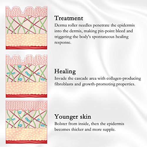 Derma Roller, Kelisidunaec 6 en 1 Rodillo Agujas, Microneedle Derma Roller Rodillo de Micro Agujas Dermaroller por Para Reducir Arrugas, Cicatrices, Celulitis, Estrías para Usar en Cara, Ojos, Cuerpo