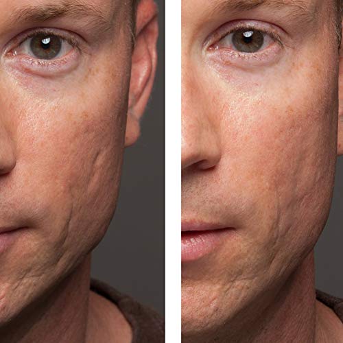 Dermaflage Cover Up - corrector de cicatrices, líneas del ceño de Hollywood Pro