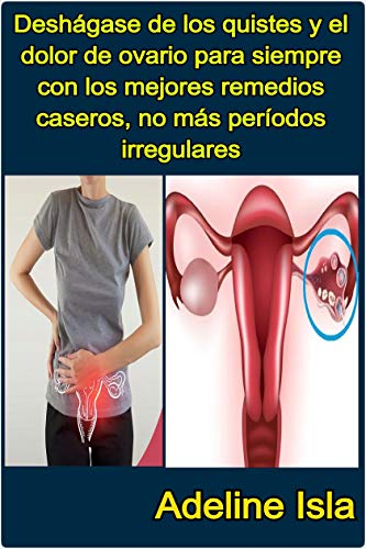 Deshágase de los quistes y el dolor de ovario para siempre con los mejores remedios caseros, no más períodos irregulares