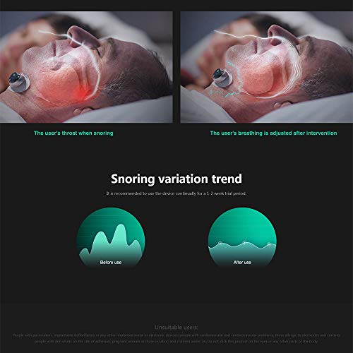 Dispositivo Inteligente Antirronquidos, Cómodo Tapón para Roncar con Control de Aplicación, Solución Eficaz para Roncar Durante el Sueño