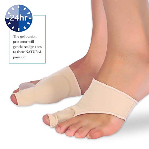 Doact Corrector de Juanetes Férula para Juanete Protector Alivio Dolor del protector dedo pie Pie, Hallux Valgus - Hombres y Mujeres(1 par) (Beige)