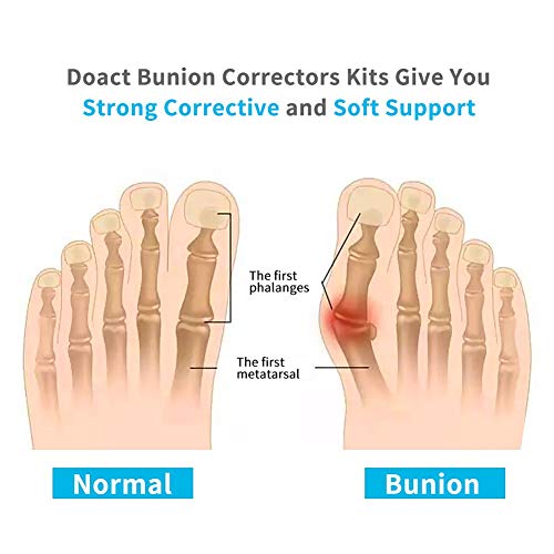 Doact Hallux Valgus Férulas, Puntera para Día y Noche en Juanete, Juanete Corrector Kit para Pérdida de Peso en la Noche Más 6pcs Gel de Alivio del Dolor para día suave para Hombres y Mujeres (L)