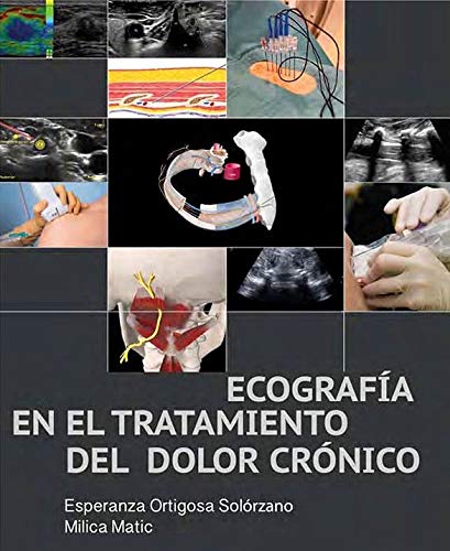 Ecografía en el Tratamiento del Dolor Crónico