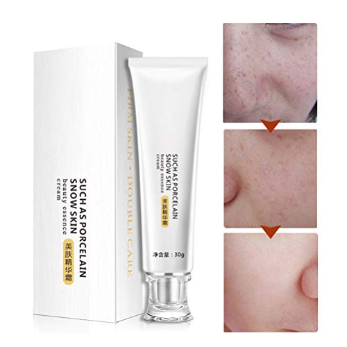 Egosy Crema blanqueadora Anti Manchas manchadas Crema Crema para el Rostro Crema para Manchas de la Edad/Manchas oscuras