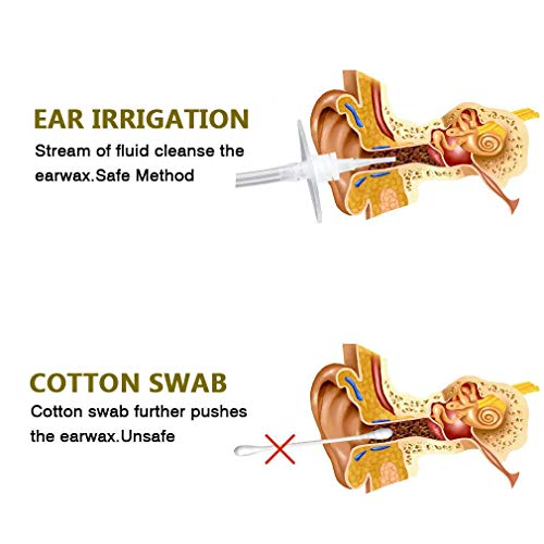 Eliminación de cera para los oídos, Limpiador de oídos Kit de lavado de oídos limpieza para oídos seguro y eficaz para adultos y niños, alivio de tapones para los oídos, picazón, mejorar la audición