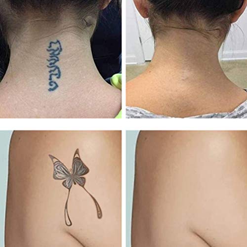EXCEART Crema para Eliminar Tatuajes El Gel para Eliminar Tatuajes Elimina sin Dolor su Tatuaje O Cosméticos Permanentes sin Dejar Cicatrices