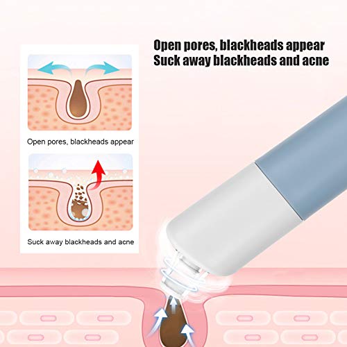 Extractor De Puntos Negros, Limpiador Facial De Nariz Recargable Por Usb, 3 Niveles De Potencia Removedor De Puntos Negros Multifuncional 4 Cabezales De Belleza Reemplazables(Azul)