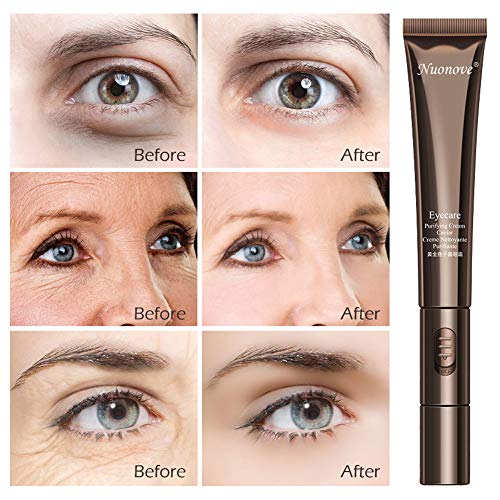 Eye Cream, Crema Contorno Ojos Mujer, Crema de Ojos Ojeras, Masaje eléctrico, Crema hidratante para ojos para eliminar el edema ocular, Reducir las ojeras, arrugas, líneas finas, anti edad, 20g