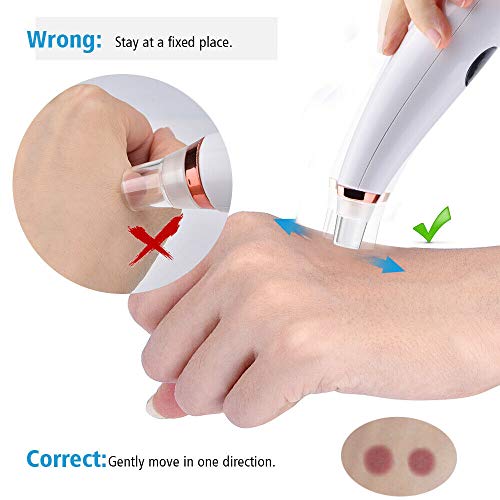 FEITA - Limpiador eléctrico para puntos negros, dispositivo para extraer espinillas, eliminación de puntos negros, acné y comedones, con 6 sondas, multifunción, recargable, para mujeres y hombres