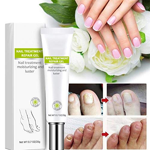 FONGDY Nagelreparaturcreme Onychomykose-Reparaturcreme,Suavizante De UñAs De Los Pies, SolucióN para UñAs Duras, Gruesas Y Agrietadas, Repara (2pcs) (5pcs)