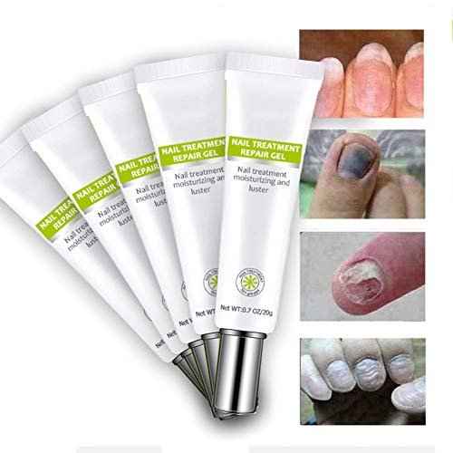 FONGDY Nagelreparaturcreme Onychomykose-Reparaturcreme,Suavizante De UñAs De Los Pies, SolucióN para UñAs Duras, Gruesas Y Agrietadas, Repara (2pcs) (5pcs)