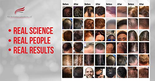 Hair Restoration Laboratories, LLC Champú para la pérdida del cabello DHT que restaura el cabello previene la caída del cabello y promueve el crecimiento del cabello para hombre y mujer
