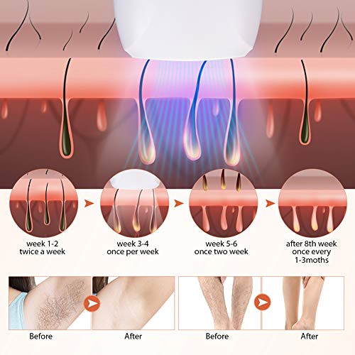HALOVIE - Depiladoras con luz pulsada (2 modos, 5 niveles de energía con 999999 flashes IPL, dispositivo de depilación profesional, portátil, depilación permanente para cuerpo cara, camiseta de aletas
