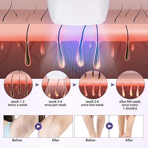 Halovie Depiladoras de luz pulsada con 2 modos 5 niveles de energía con flashes IPL dispositivo de depilación profesional portátil depilación permanente para cuerpo facial