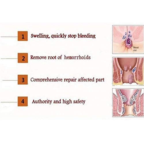 HEMORELIEF CREAM crema herbal china de alivio rápido Crema para hemorroides Gel externo (3 Pcs)
