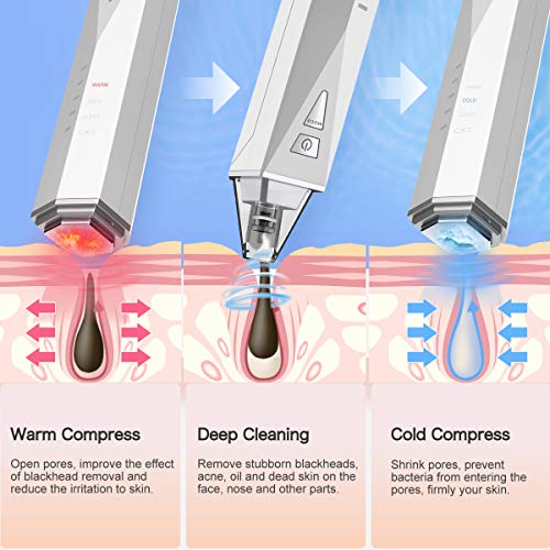 HeomBliss Limpiador de Poros Electrónico Limpiador Puntos Negros, Eliminador de Puntos Negros 4 Cabezales 5 Velocidades, Extractor de Puntos Negros con Compresas Frías