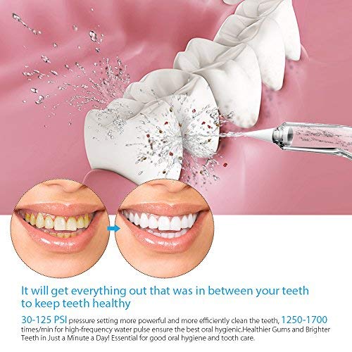 Homgeek Irrigador Bucal, Irrigador Dental Profesional con 7 Boquillas Multifuncionales 10 Ajustes de Presión 600ml, Efectivamente Limpia los Dientes y Protege la Salud Bucal de Toda la Familia