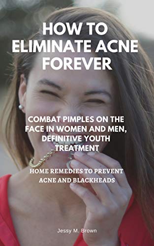 HOW TO ELIMINATE ACNE FOREVER : COMBAT PIMPLES ON THE FACE IN WOMEN AND MEN, DEFINITIVE JUVENILE TREATMENT, HOME REMEDIES TO PREVENT ACNE AND BLACKHEADS (English Edition)