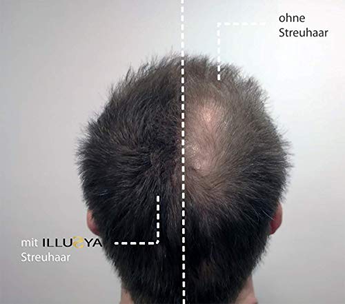 ILLUSYA® Hair Fiber - Caída del cabello - Fibras capilares para el engrosamiento del cabello. marca de primera calidad. Cabello completo en segundos. 25g (NEGRO)