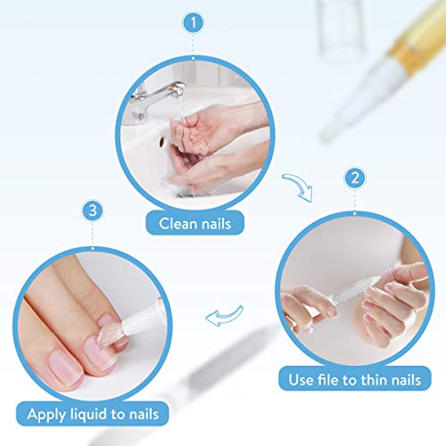 Janolia Tratamiento de Uñas, Pluma de Reparación de Uñas & Lima de Uñas, Solucionar los Onicomicosis, Reparar Las Uñas, Retirar Dedos Infectados Amarillos, Cuidado de Uñas Seguro y Natural