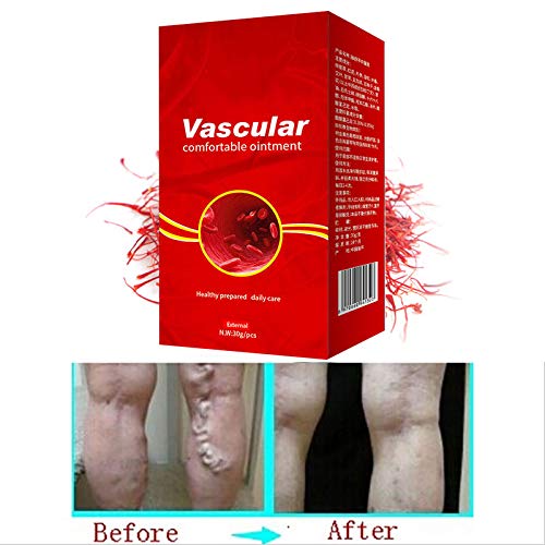 Jiayuane Ampliación de la vena varicosa Ungüento Tratamiento Alivio Flebitis Angiitis Vasos Sangre Podrida Salud