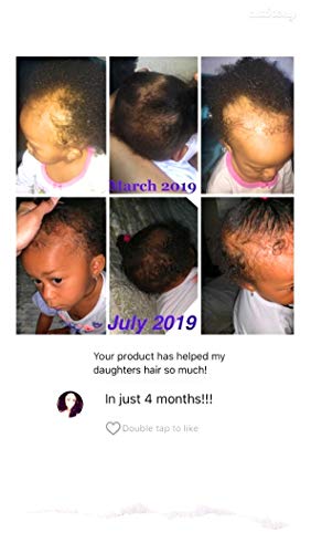 J’Organic Solutions Biotin hair growth Stimulating Conditioner (for kids) with Argan Oil, Aloa Vera & more