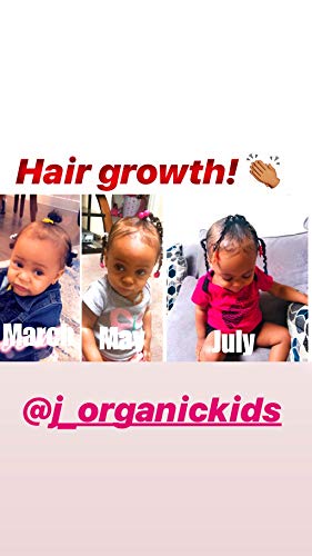 J’Organic Solutions Biotin hair growth Stimulating Conditioner (for kids) with Argan Oil, Aloa Vera & more