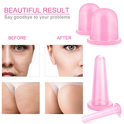 Juego de 8 Ahuecamientos para Ahuecamiento de Cuerpo y Cara Copa de Masaje Tazas Ventosas de Cuerpo de Silicona con Cepillo Exfoliante para Cara Cuello Piel Piernas Vientre y Trasero