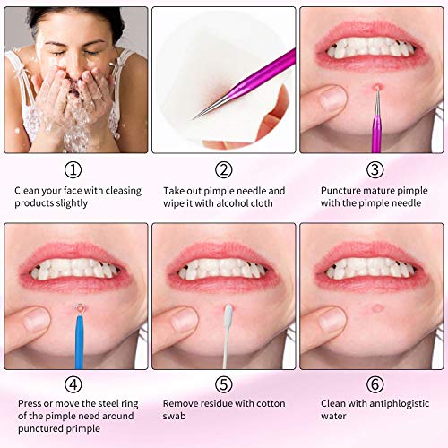 Kapmore Aguja Extractor Limpiador Juego de 10 Pcs Kit Blackhead Remover para Acné Punto Negro Comedones BlackHead Extractor (Negro)