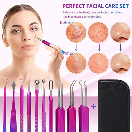 Kapmore Aguja Extractor Limpiador Juego de 10 Pcs Kit Blackhead Remover para Acné Punto Negro Comedones BlackHead Extractor (Negro)
