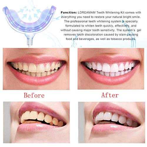 Kit de Blanqueamiento Dental,Kit de Blanqueamiento de Dientes,Gel Blanqueador de Dientes,Teeth Whitening Kit,Blanqueamiento Dientes, Teeth Whitening Kit Profesional Blanqueamiento Dientes