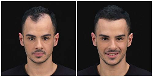 Kmax Concealing Hair Fibers – Fibras capilares de ocultamiento – 27,5 g negro