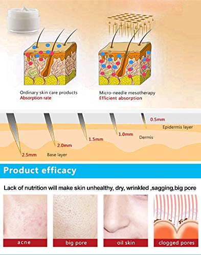 KYTRIBE Dermaroller ZGTS 192 Derma Roller 1.5mm, Tratar cara, cuerpo, flacidez, celulitis, estrías blancas, manchas, alopecia, calvicie, pelo, cicatrices, marcas, poros dilatados (ZGTS-192, 1.5mm)