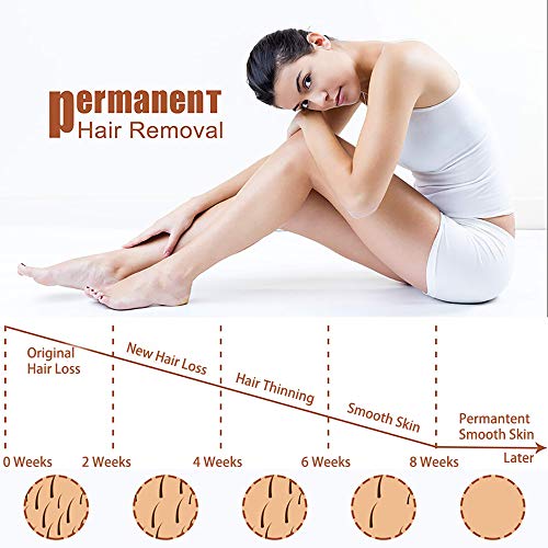 La eliminación del pelo IPL Sistema, sin dolor permanente 999.999 Flashes para hombres de las mujeres sin dolor permanente de depilación láser en-Hogar de dispositivos, Profesional de cuerpo completo,A