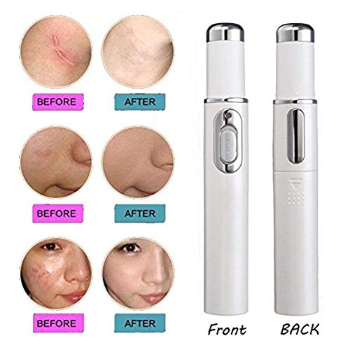 Lápiz para eliminar el acné, instrumento potente anti venas varicosas, anti acné, para mejorar la piel