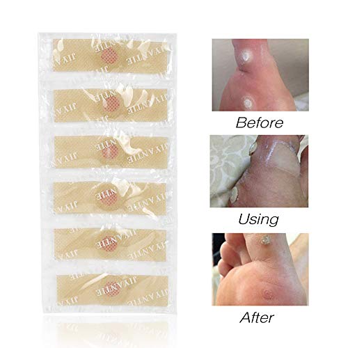 Lebeaut 36 Unids/caja Pie Remoción de Maíz Yeso con Agujero Verrugas Thorn Parche Callo Quitar Suavizar Cutin de la Piel Etiqueta Cura Protector del Dedo del pie