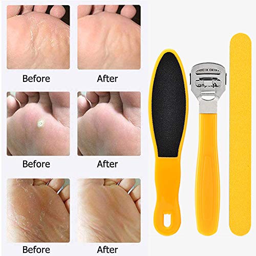 Lima de Pies,Kit de Pedicura,Pedicure Foot File,10 en 1 Kit de herramientas de pedicura profesional, Conjunto de pie de Acero Inoxidable Escofina de pie Remover la Piel Muerta Para el Cuidado
